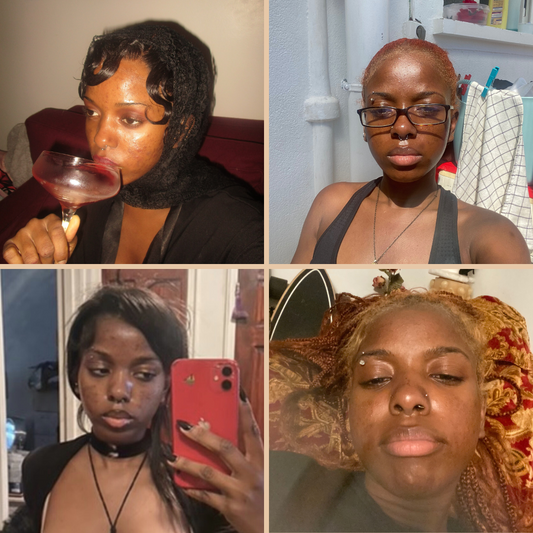 Glow Diaries